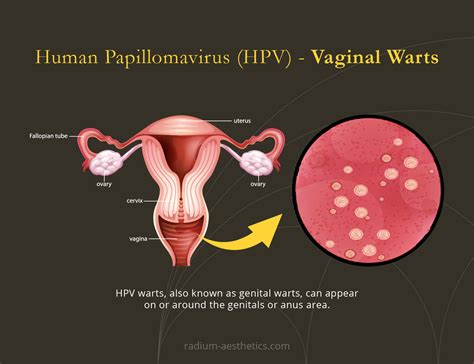 HPV Screening | Radium Medical Aesthetics Singapore