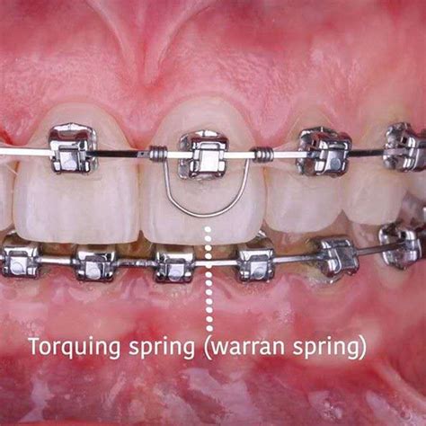 Image result for Torque Spring