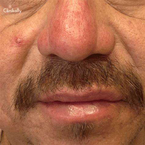 Doctor Recommended Anti-Aging Superstars for Ageing Skin | Clinikally