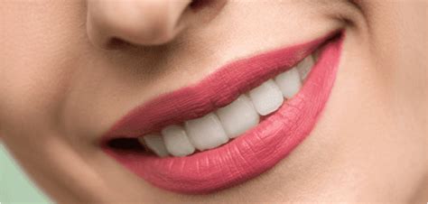 Image result for Teeth Staining Causes