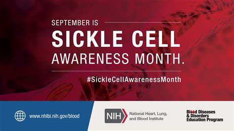 Sickle Cell Disease Awareness Month – The Rotation: A Himmelfarb Library Blog