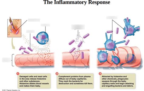 Image result for Inflammation Reaction