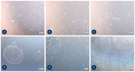 A Novel Protocol for Culturing Polarized Proximal Tubular Epithelial ...