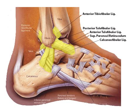 ankle ligament surgery