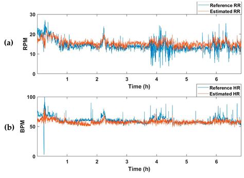 Image result for Calman Remote Neural Monitoring