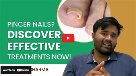 Pincer Fingernails: Symptoms, Causes & Treatment Options