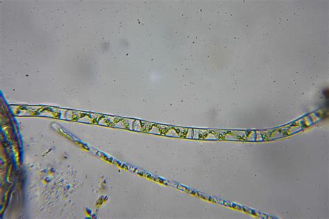Spirogyra | The Microscopic Life of Shetland Lochs