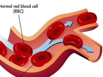 शरीर में हीमोग्लोबिन कम होने पर मिलती हैं 10 चेतावनी, तेजी से खून ...