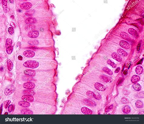 Function Of Simple Columnar Epithelium In Gallbladder at Cruz Ybarra blog