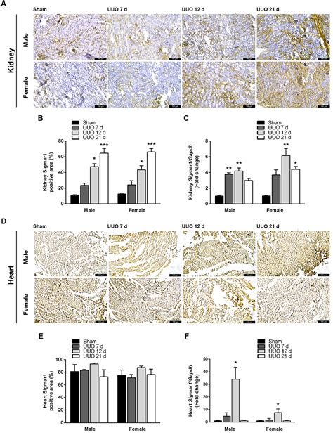 The Sigma-1 Receptor Exacerbates Cardiac Dysfunction Induced by ...