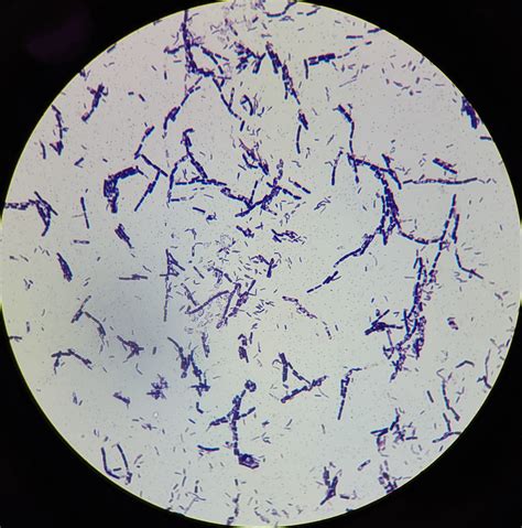 E.coli Gram Stain Escherichia Coli Wikipedia