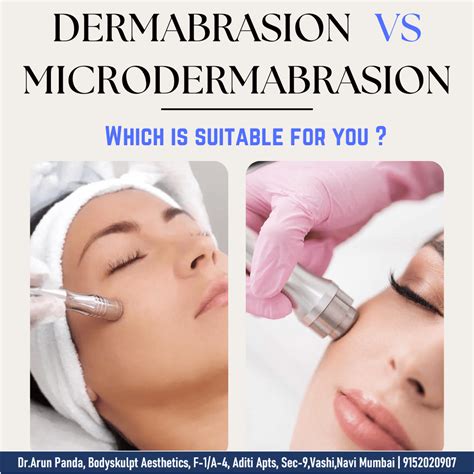 MICRODERMABRASION VS. DERMABRASION What's the difference? Cost in India