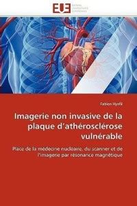 Imagerie Non Invasive de la Plaque d''ath roscl rose Vuln rable: Buy ...