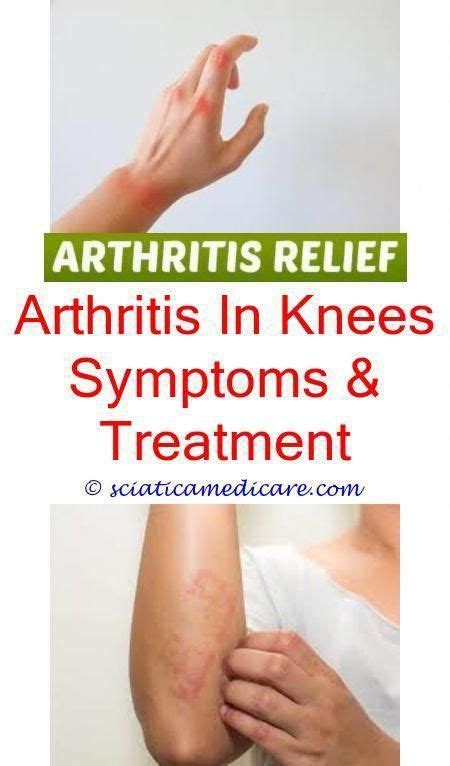 Understanding Reactive Arthritis (With images) | Knee arthritis