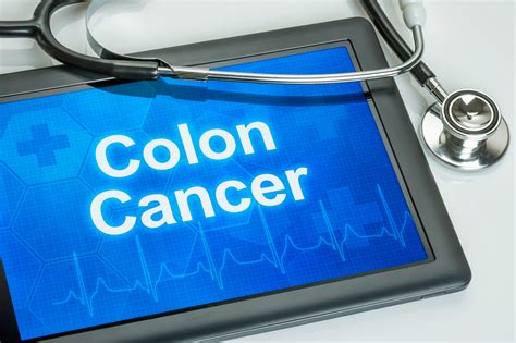 Image result for Colon Cancer Testing