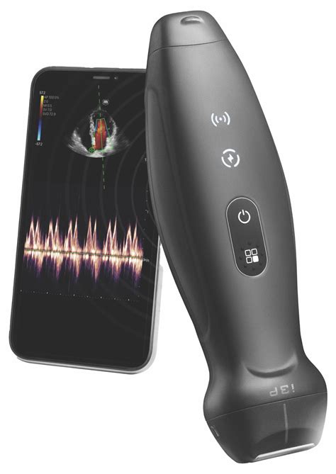Handheld Ultrasound