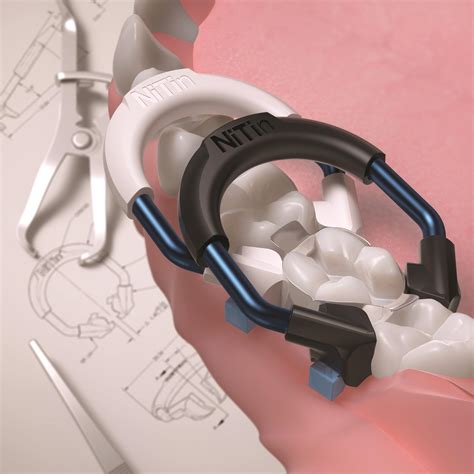 Image result for Sectional Matrix