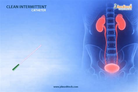 Clean Intermittent Catheter (CIC) - Safe Bladder Emptying Solution ...