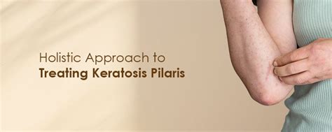 Holistic Approach to Treating Keratosis Pilaris – Fixderma Skincare