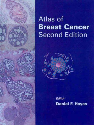 Details for ATLAS OF BREAST CANCER › MGM Medical College catalog