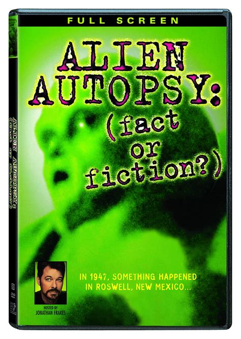 Image result for Alien Autopsy 1947 Video Gary Shoefield