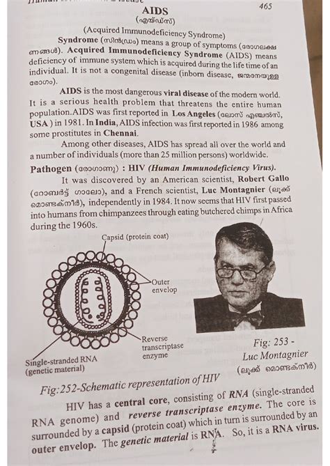AIDS - About AIDS - AIDS 465 (nown) (Acquired Immunodeficiency Syndrome ...