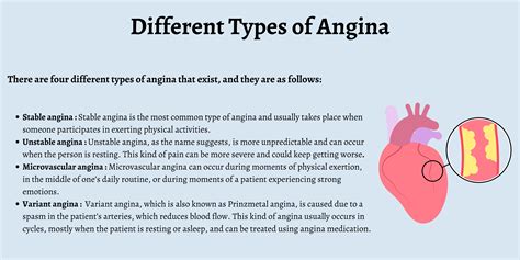 What Is Short For Vincent at Rita Skelley blog