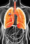 Lung Cancer 的图像结果