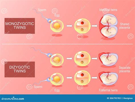 Zygote Developments In Monozygotic And Dizygotic Twins Cartoon Vector | CartoonDealer.com #306795783