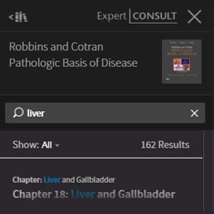 Buy Robbins and Cotran Pathologic Basis of Disease Professional Edition ...