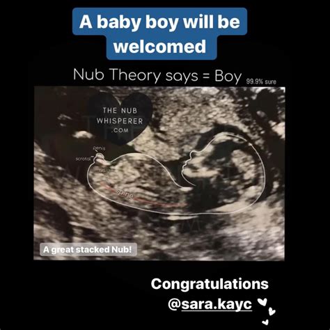 13 Week Ultrasound Boy