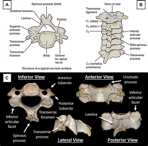 Normal and Variant Anatomy of the Cervical Spine - Oral and Maxillofacial Surgery Clinics