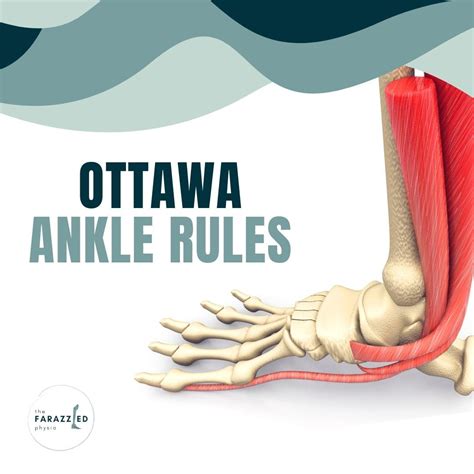 Faraz Sethi on LinkedIn: *Ottawa Ankle Rules* Current emergency ...
