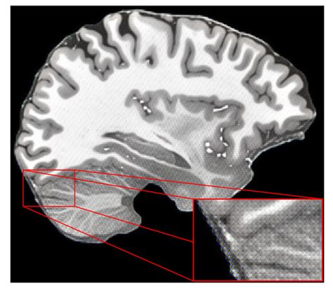 Improving Structural MRI Preprocessing with Hybrid Transformer GANs