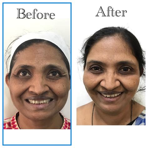 Gallery - Dermaplus
