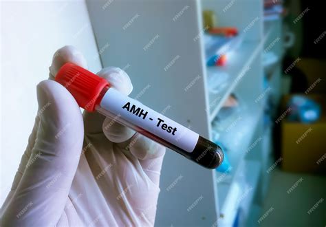 Premium Photo | Blood sample tube for amh or anti mullerian hormone test