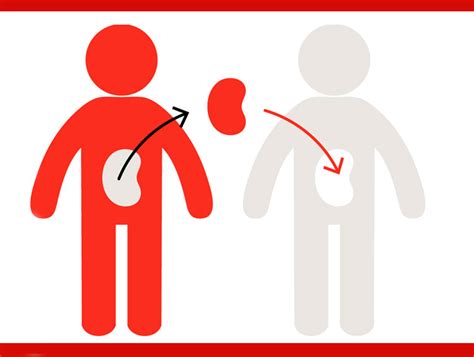 Organ Transplantation