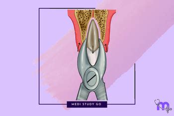 Dental Extraction Instruments & Techniques: A Complete Guide – Medi ...