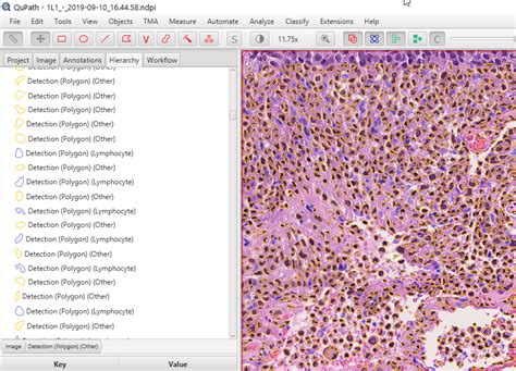 Image result for QuPath Basics