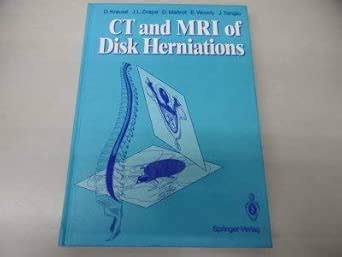 Buy Ct and Mri of Disk Herniations Book Online at Low Prices in India ...