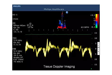 Philips - CX50 POC Ultrasound system