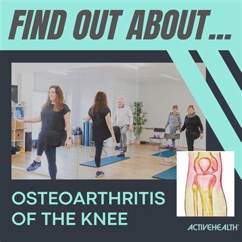 Osteoarthritis Disability Hands at Rebecca Skinner blog