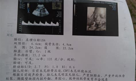 怀孕27周彩超图像帮忙看男女-孕中期(13-28周)-准妈妈论坛-杭州19楼