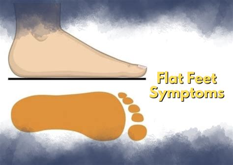 Managing Knee Pain From Flat Feet - Feet Relief
