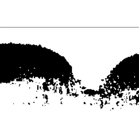 Image result for Sebum Extraction Tools