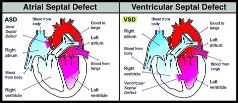 Heart Diagram Septum