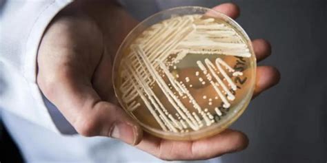 超级真菌概念股总结 ‘超级真菌’指的是耳念珠菌。目前美国已有587个病例，并且半数感染病人在90天内死亡。这种致命的超级真菌具有抗药性，并且 ...
