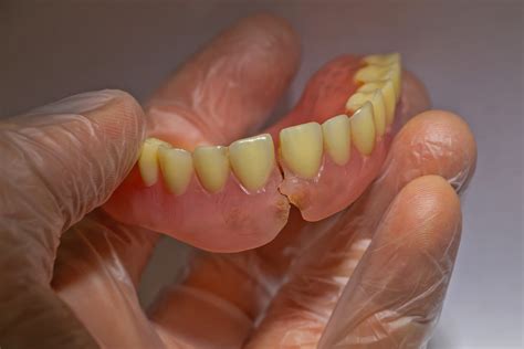 Image result for Dentures Adjustment Tips