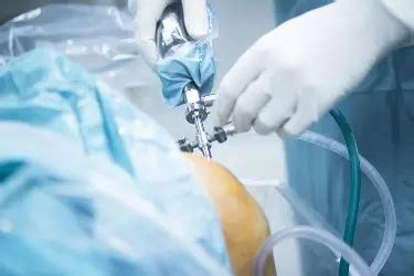 Rotator Cuff Injury Treatment | Shiva Hospital madhepura