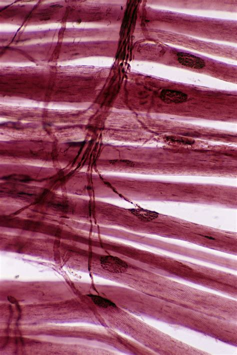 Living With Pompe Means Listening to Your Body When It Talks